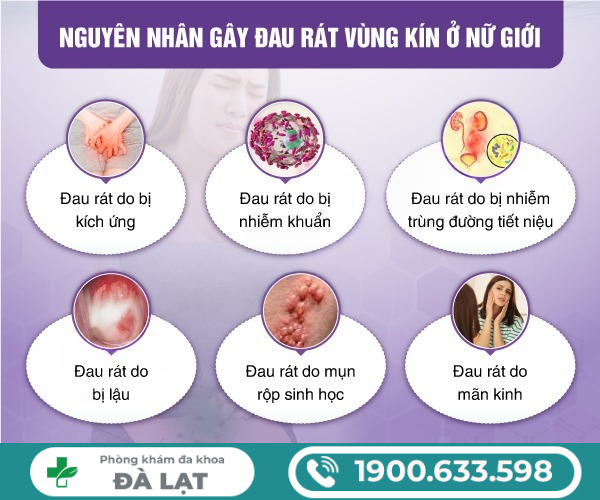 Hình ảnh minh họa